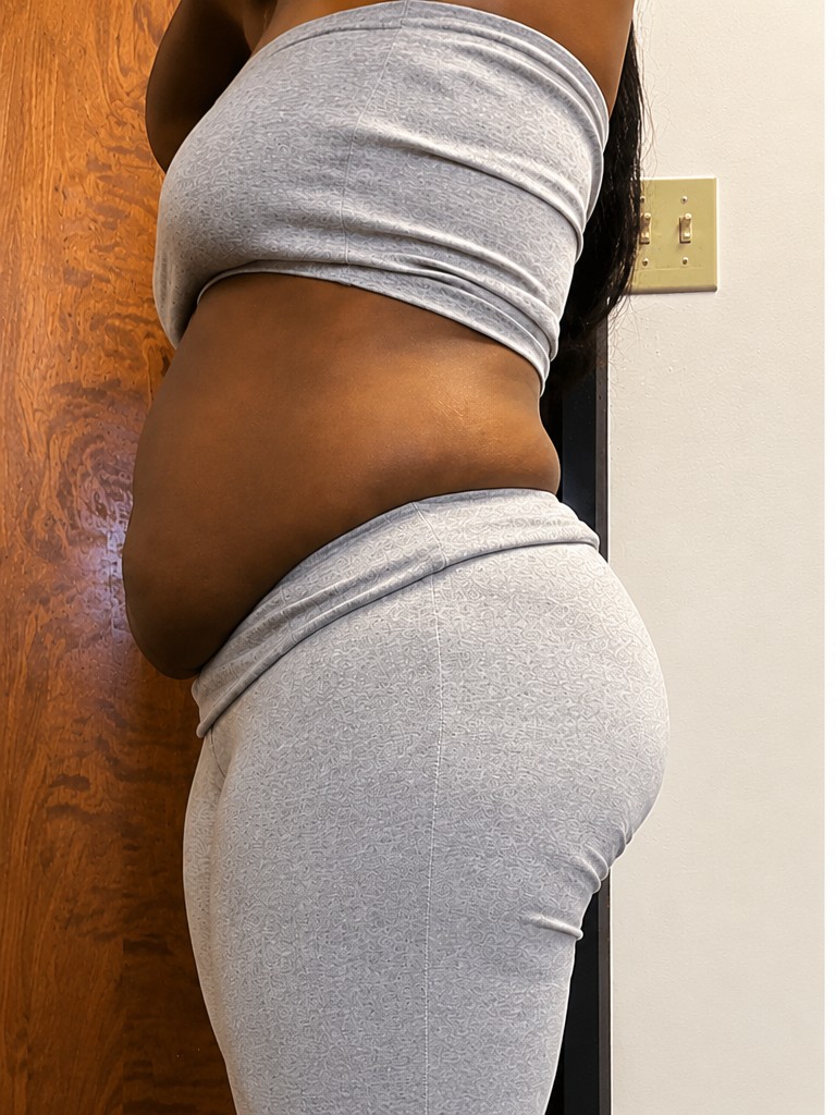 Before measurement